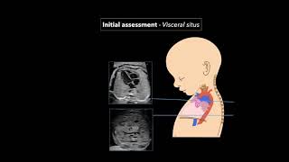 Fetal Echocardiography Protocol and Technique [upl. by Molohs139]