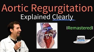 Aortic Regurgitation Aortic Insufficiency Explained Clearly  Remastered [upl. by Yvad277]