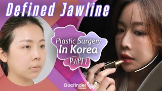 Best Plastic Surgery in Korea Review  Part 1 [upl. by Dlanigger820]