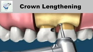 How To Cut amp Install Crown Moulding [upl. by Chong]