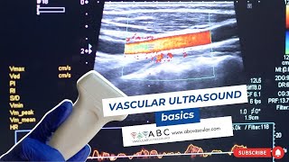 Vascular ultrasound basics [upl. by Tallu]